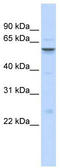 Insulin Like Growth Factor Binding Protein Acid Labile Subunit antibody, TA346388, Origene, Western Blot image 