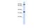 Ribosomal RNA Processing 1B antibody, A08159, Boster Biological Technology, Western Blot image 