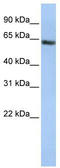 Fanconi anemia group E protein antibody, TA333716, Origene, Western Blot image 