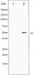 Serum Response Factor antibody, TA325884, Origene, Western Blot image 