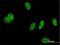 PHIP antibody, H00055023-M01, Novus Biologicals, Immunofluorescence image 