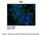 Zinc Finger E-Box Binding Homeobox 1 antibody, PA5-40350, Invitrogen Antibodies, Immunohistochemistry paraffin image 
