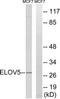 ELOVL Fatty Acid Elongase 5 antibody, TA315700, Origene, Western Blot image 