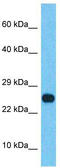 SSX Family Member 2B antibody, TA339917, Origene, Western Blot image 