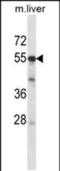 AarF Domain Containing Kinase 2 antibody, PA5-48701, Invitrogen Antibodies, Western Blot image 