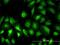 Phosphoglucomutase 1 antibody, H00005236-M01, Novus Biologicals, Immunofluorescence image 