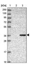 Corticotropin-releasing factor-binding protein antibody, PA5-61157, Invitrogen Antibodies, Western Blot image 