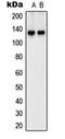SH3 And Multiple Ankyrin Repeat Domains 2 antibody, orb215063, Biorbyt, Western Blot image 