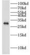 Probable gluconokinase antibody, FNab04126, FineTest, Western Blot image 