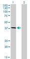 Homeostatic Iron Regulator antibody, LS-C197405, Lifespan Biosciences, Western Blot image 