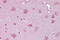 Norrin Cystine Knot Growth Factor NDP antibody, ARP56082_P050, Aviva Systems Biology, Immunohistochemistry paraffin image 