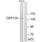 Centrosomal Protein 135 antibody, MBS9410736, MyBioSource, Western Blot image 