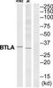 B And T Lymphocyte Associated antibody, TA313391, Origene, Western Blot image 