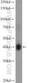 V-Set And Transmembrane Domain Containing 1 antibody, 24382-1-AP, Proteintech Group, Western Blot image 