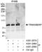 Tripartite Motif Containing 3 antibody, A301-208A, Bethyl Labs, Immunoprecipitation image 