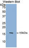 Platelet Derived Growth Factor Subunit A antibody, LS-C295958, Lifespan Biosciences, Western Blot image 