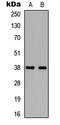 TATA-Box Binding Protein antibody, LS-C358352, Lifespan Biosciences, Western Blot image 