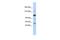 U2 SnRNP Associated SURP Domain Containing antibody, PA5-41970, Invitrogen Antibodies, Western Blot image 
