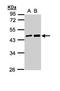 MAGE Family Member A11 antibody, LS-C186156, Lifespan Biosciences, Western Blot image 