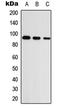 Unc-5 Netrin Receptor A antibody, LS-C354492, Lifespan Biosciences, Western Blot image 