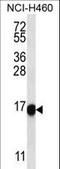 Uncharacterized protein CXorf1 antibody, LS-C159421, Lifespan Biosciences, Western Blot image 