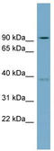 Radial Spoke Head 14 Homolog antibody, TA334536, Origene, Western Blot image 