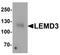 LEM Domain Containing 3 antibody, TA319866, Origene, Western Blot image 