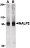 NBS1 antibody, PA5-20213, Invitrogen Antibodies, Western Blot image 