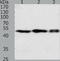 F7 antibody, TA323734, Origene, Western Blot image 