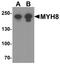 Myosin Heavy Chain 8 antibody, A08502, Boster Biological Technology, Western Blot image 