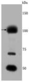 Fibroblast Growth Factor Receptor 3 antibody, NBP2-66839, Novus Biologicals, Western Blot image 