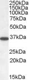 Protein Phosphatase 2 Catalytic Subunit Alpha antibody, TA302738, Origene, Western Blot image 