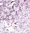 Hepatocyte Growth Factor antibody, orb10422, Biorbyt, Immunohistochemistry paraffin image 