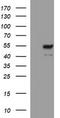 Matrix Metallopeptidase 13 antibody, CF506723, Origene, Western Blot image 