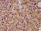 UDP Glucuronosyltransferase Family 1 Member A1 antibody, CSB-PA025570LA01HU, Cusabio, Immunohistochemistry paraffin image 