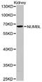NUMB Like Endocytic Adaptor Protein antibody, MBS127004, MyBioSource, Western Blot image 