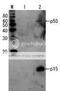 HIV1 gp41 antibody, 65-012, BioAcademia Inc, Western Blot image 