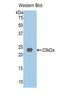 Homogentisate 1,2-Dioxygenase antibody, LS-C300238, Lifespan Biosciences, Western Blot image 