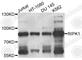 Receptor-interacting serine/threonine-protein kinase 1 antibody, A7414, ABclonal Technology, Western Blot image 