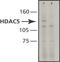 Histone Deacetylase 5 antibody, ab50001, Abcam, Western Blot image 