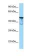 Shootin 1 antibody, orb326162, Biorbyt, Western Blot image 