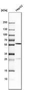 Propionyl-CoA Carboxylase Subunit Beta antibody, HPA036940, Atlas Antibodies, Western Blot image 