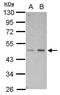 HtrA Serine Peptidase 3 antibody, PA5-30905, Invitrogen Antibodies, Western Blot image 