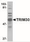 Tripartite motif-containing protein 30 antibody, NBP2-41086, Novus Biologicals, Western Blot image 