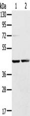 Ras Related GTP Binding A antibody, TA350374, Origene, Western Blot image 