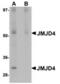 Jumonji Domain Containing 4 antibody, TA306833, Origene, Western Blot image 