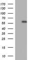 Matrix Metallopeptidase 13 antibody, TA506699S, Origene, Western Blot image 
