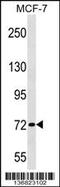 Zinc Finger Protein 408 antibody, 58-897, ProSci, Western Blot image 