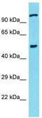 Cysteine And Serine Rich Nuclear Protein 3 antibody, TA335455, Origene, Western Blot image 