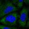 N(Alpha)-Acetyltransferase 30, NatC Catalytic Subunit antibody, HPA057824, Atlas Antibodies, Immunofluorescence image 